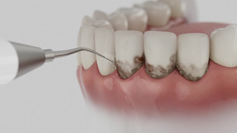 Trusted Teeth Cleaning And Checkup service in Mount Prospect, IL - Dentist Open Now